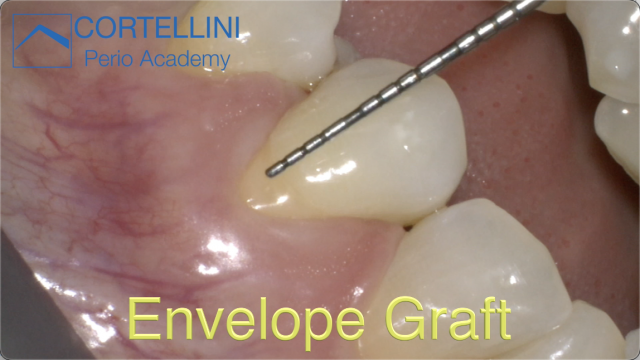 The Envelope Technique